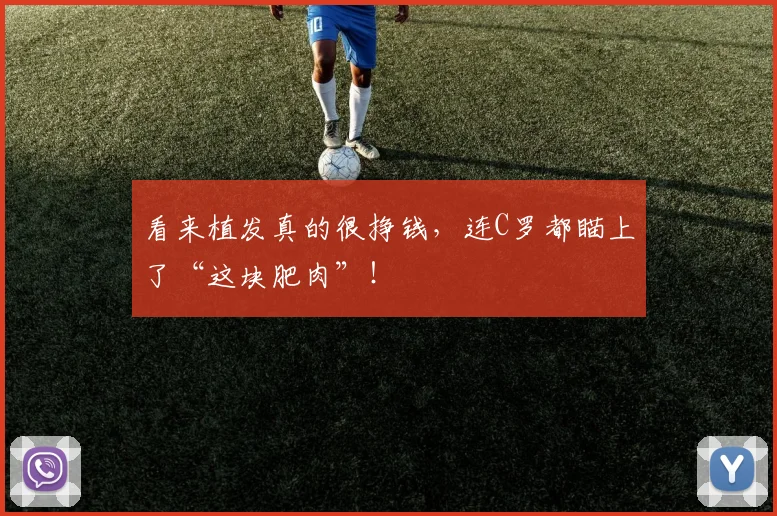 看来植发真的很挣钱，连C罗都瞄上了“这块肥肉”！